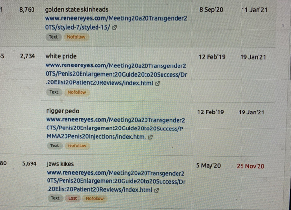 Dr. Elist Implant Before After Image Racist